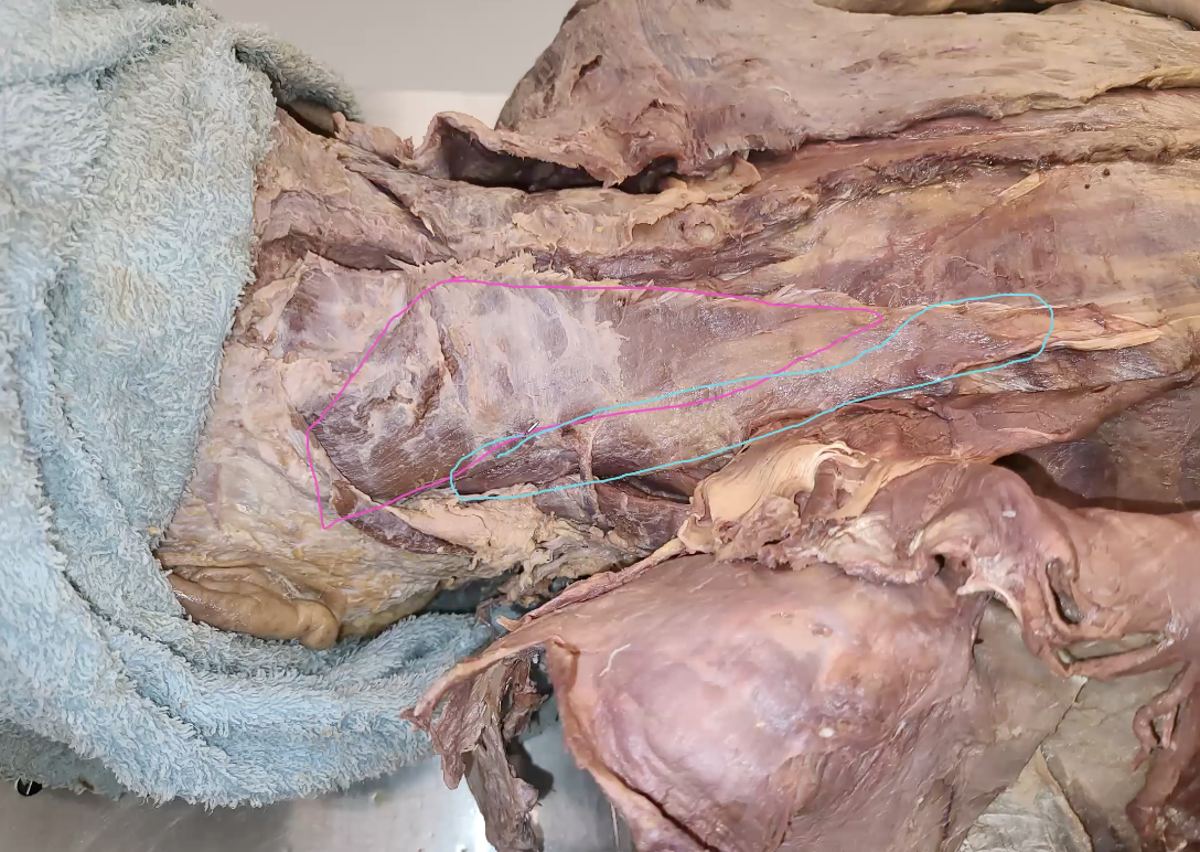 <p>after reflecting the serratus posterior superior, what is the one in the blue</p>