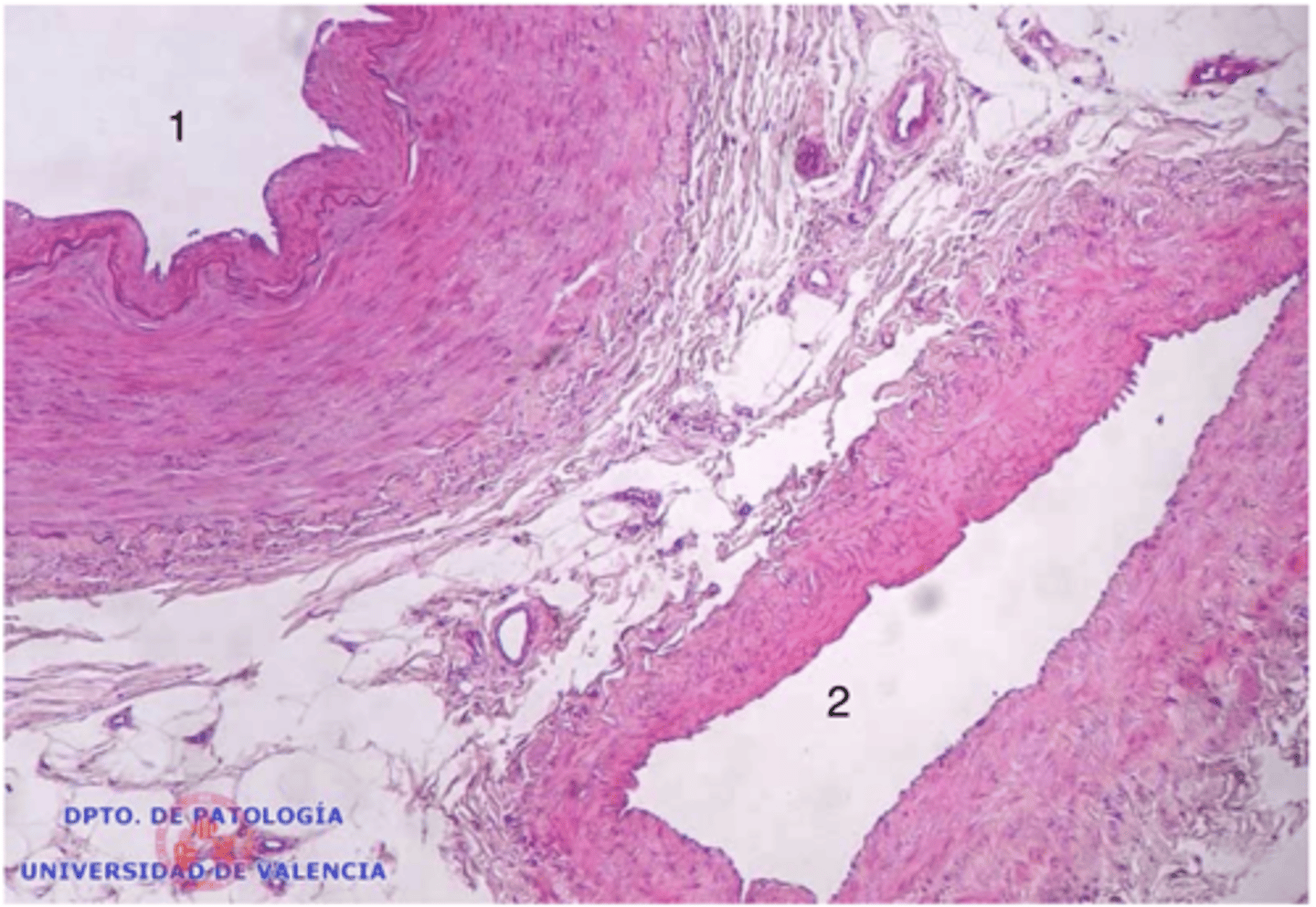 <p>which is an artery and which is a vein?</p>