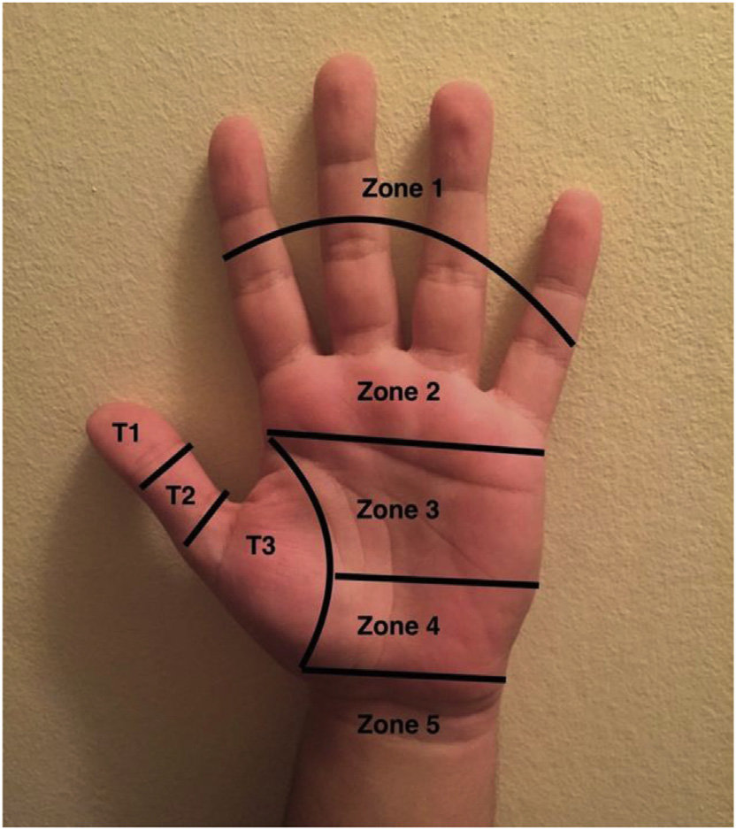 <p>Zones I and II</p>