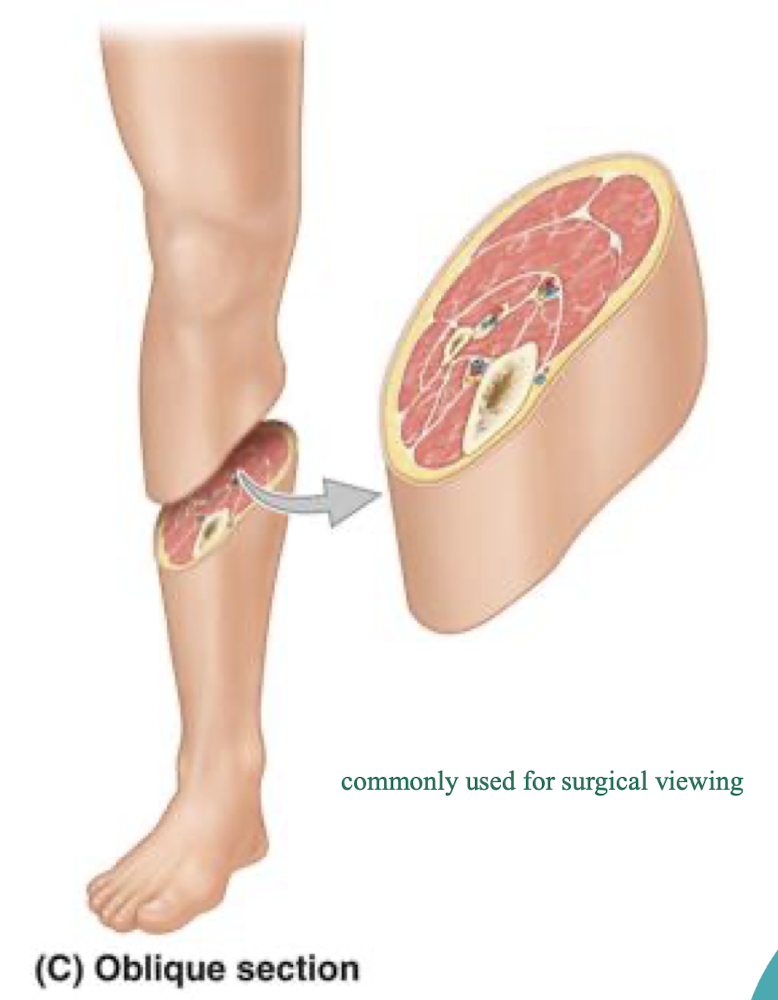 <p><strong>oblique plane </strong>- passes through the body or an organ at an angle, commonly used for surgical viewing</p><ul><li><p>combining features of transverse + sagittal <strong><span>or</span></strong> transverse + frontal planes because it is a diagonal slice at an angle</p></li></ul><p></p>