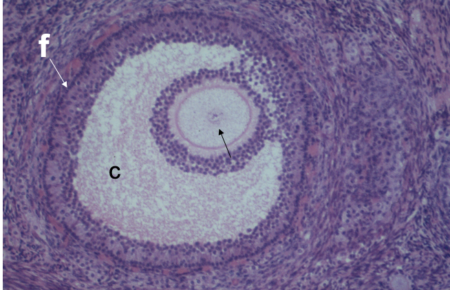 <p>What cell is the black arrow pointing to? </p>