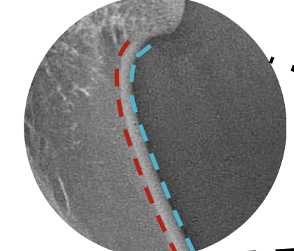 <p>what layer of bone is the blue?</p>