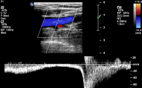 <p><span>This waveform indicates&nbsp;</span></p>