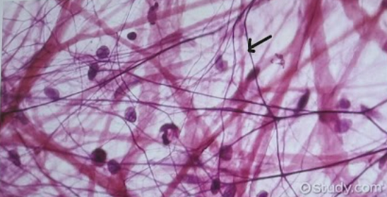 <p>Identify the type of connective tissue</p>