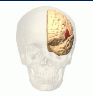 <p>whata area of the brain is this?…</p>