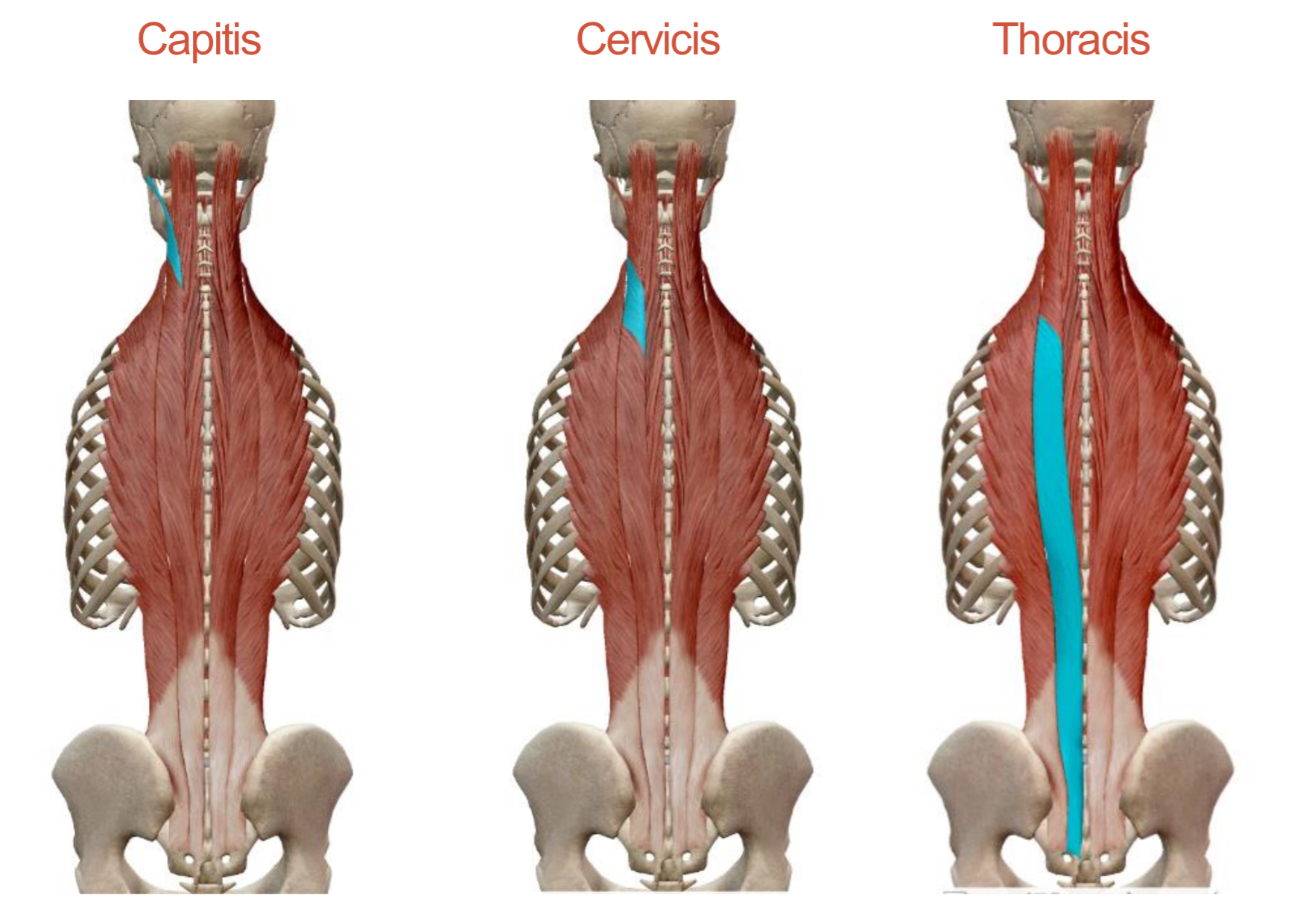 <p>Erector Spinae: Longissimus </p><p>Origin:&nbsp;</p><p><strong>Capitis</strong>: TP of T1-T4 vertebrae and articular processes of C4-C7</p><p><strong>Cervicis</strong>: TP of T4-T5</p><p><strong>Thoracis</strong>: TP of L1-L5</p><p>Insertion:</p><p><strong>Capitis</strong>: Mastoid process</p><p><strong>Cervicis</strong>: TP of C2-C6</p><p><strong>Thoracis</strong>: TP of thoracic and lumbar vertebrae, ribs 9 and 10</p><p>Action: <strong>Together</strong>: Extend vertebral column at respective region <strong>Singly</strong>: Laterally flex vertebral column of respective region</p><p>Innervation: Spinal Nerves</p>