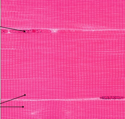 <p>Which type of muscle is:</p><ul><li><p>Striated, voluntary, and multinucleated</p><ul><li><p>are long and thin, are usually called muscle fibers</p></li></ul></li></ul><p></p>