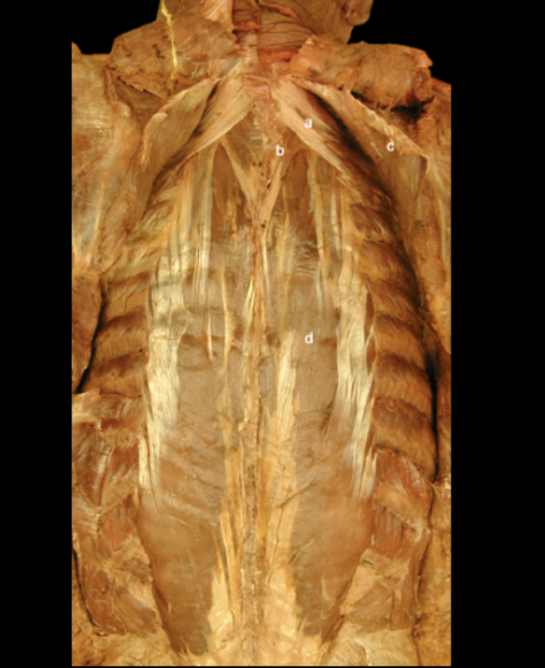 <p>Intrinsic Muscles of the Back</p>