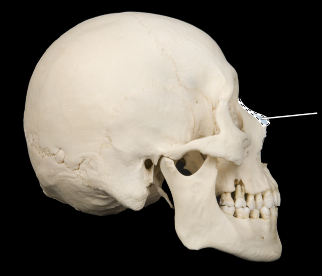 <p>Name this bone.</p><p>(Skull, lateral view).</p>