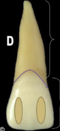 <p><mark data-color="blue" style="background-color: blue; color: inherit">maxillary central incisors #8 and #9; CEJ</mark></p>
