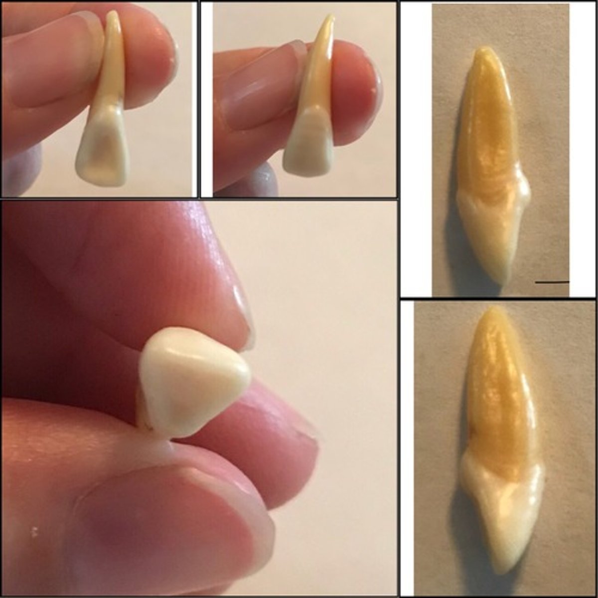 <p>What tooth is this ?</p>