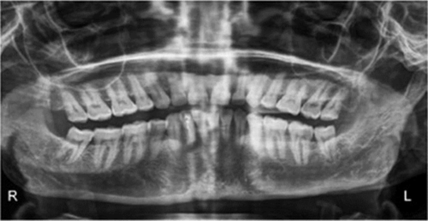 <p>chin tipped to high</p>