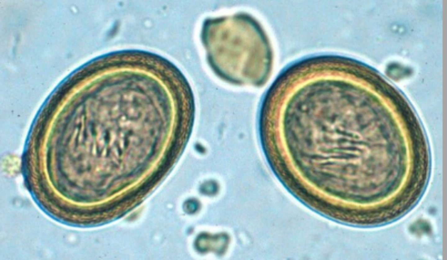 <p>These 38x32um eggs were found on a fecal flotation. What is appropriate to put in the medical notes?</p>