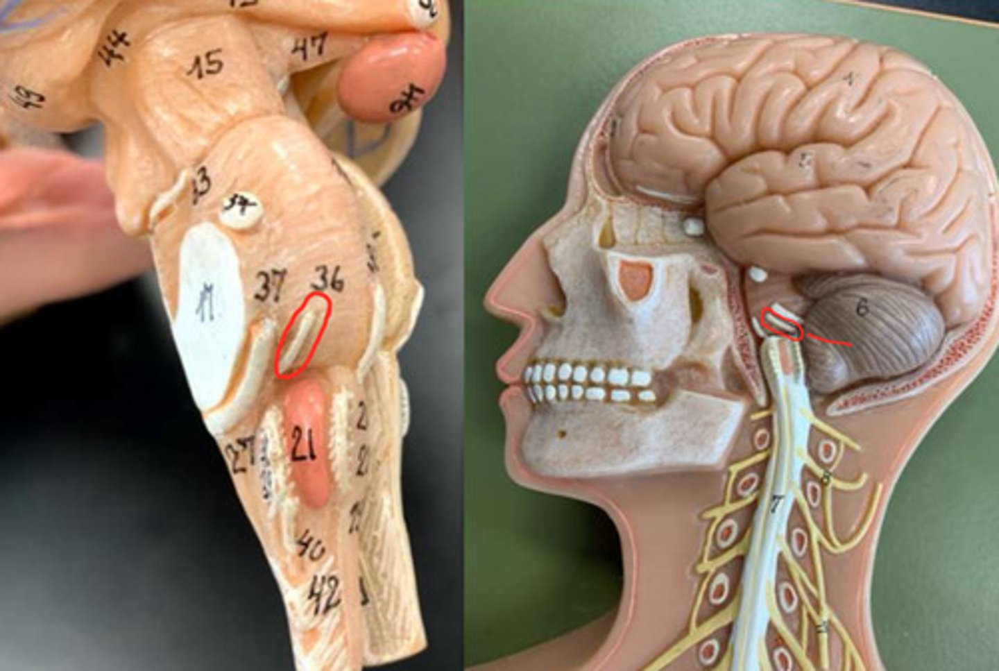 <p>through internal acoustic meastus; see from top of skull</p>
