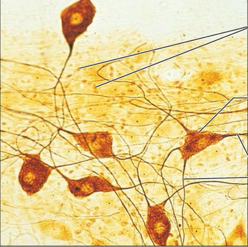 <p><strong>What is a picture example of nervous tissue?</strong></p>