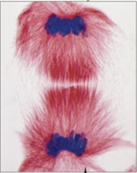 <p>what stage of mitosis?</p>