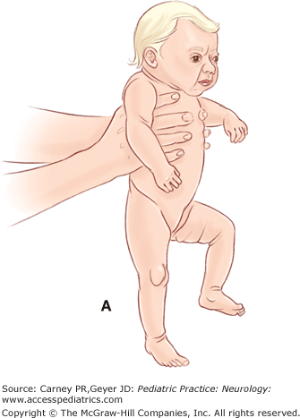 <p><strong>Stimulus:</strong> tactile contact on dorsum of foot and hand</p><p><strong>Response:</strong> extremity flexion to place hand or foot over obstacle</p><p><strong>Age of Suppression:</strong> before end of first year</p>