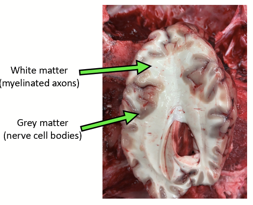 <p>Corresponds to nerve cell bodies. Found in cerebrum + spinal cord.</p><p>Where the integration of information occurs.</p>