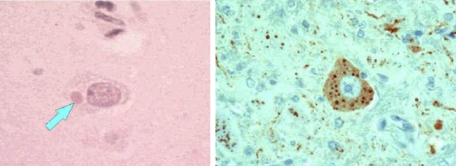 <p>Histologic exam of Rabies shows _________ bodies</p>