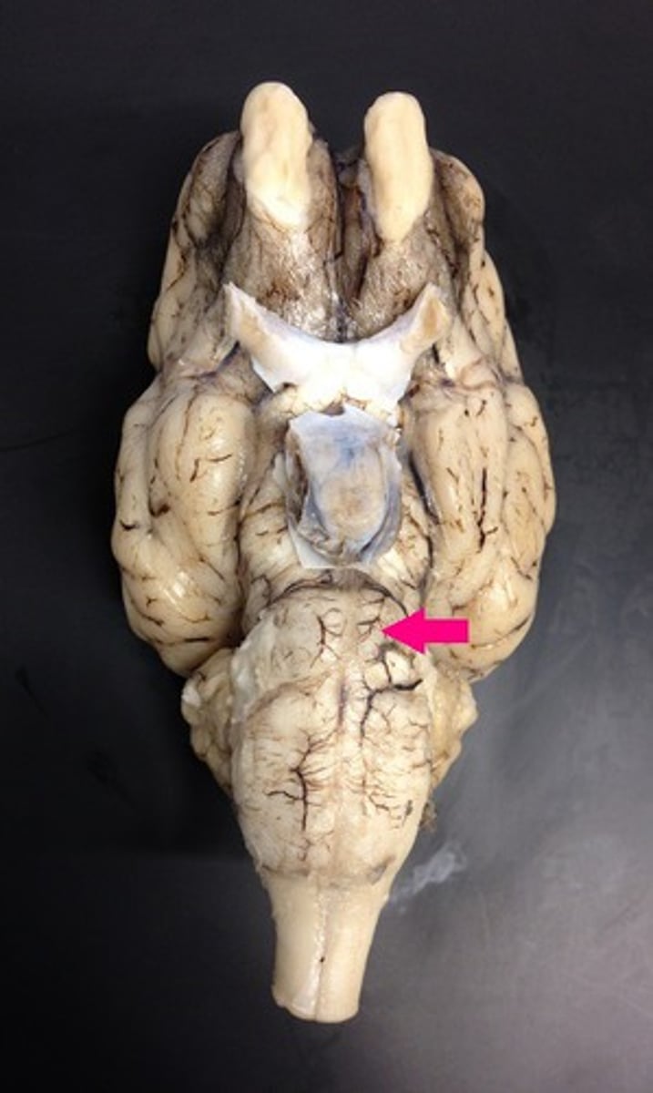 <p>Identify the structure.</p>