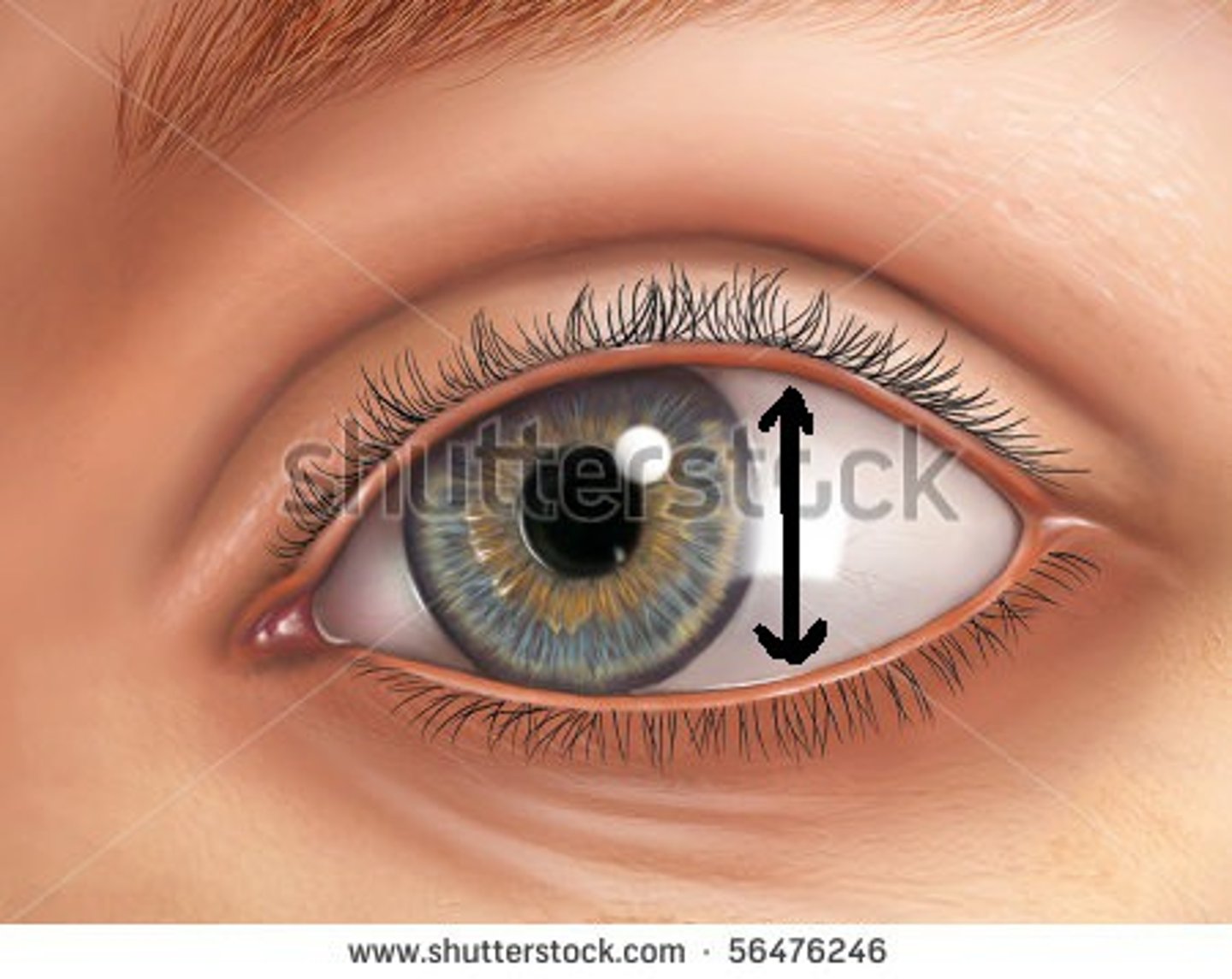 <p>space between eyelids</p>