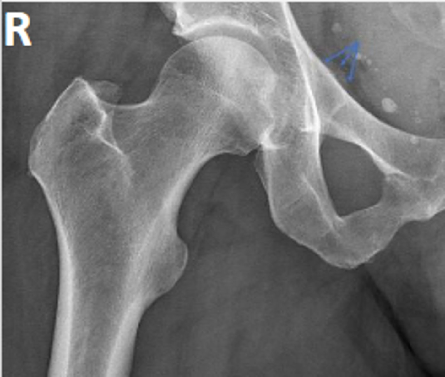 <p>What are the arrows pointing to?</p>