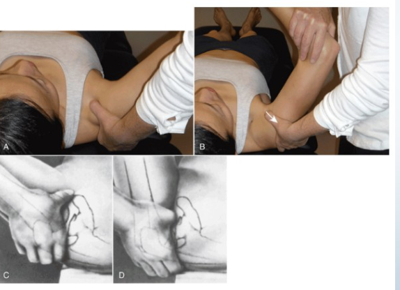 <p>Posterior Drawer Test</p>