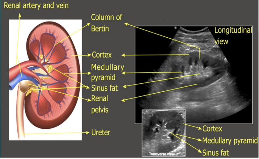 <p>Medulla </p>