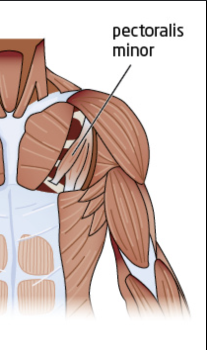 <p>underneath pectoralis major</p>