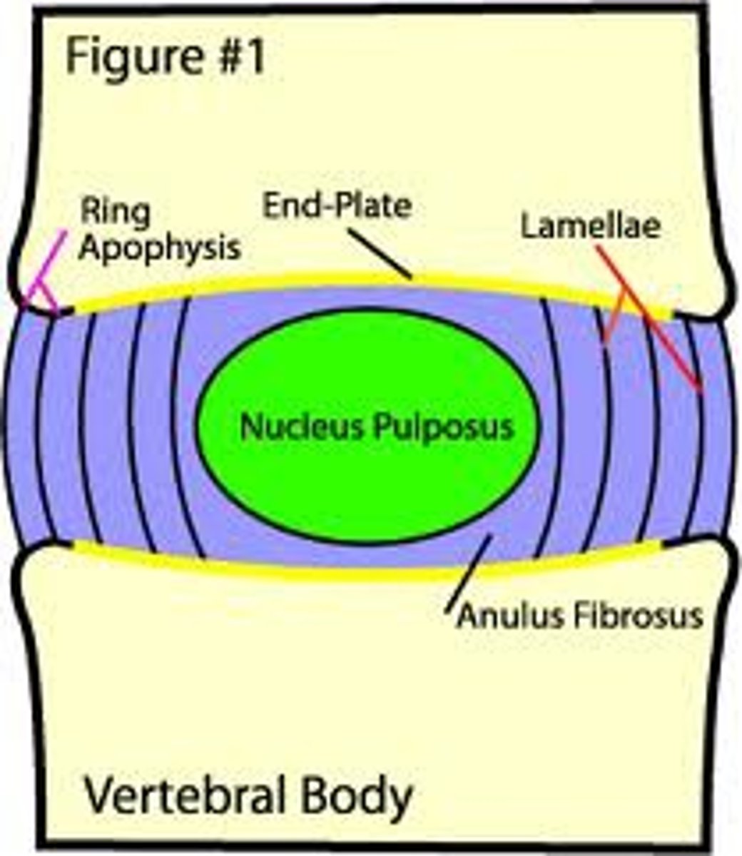 <p>deformate cartilage plate at the top and bottom of vertebrae</p><p>*thin in adults, thick at birth and function as growth plates for the vertebrae in children</p>