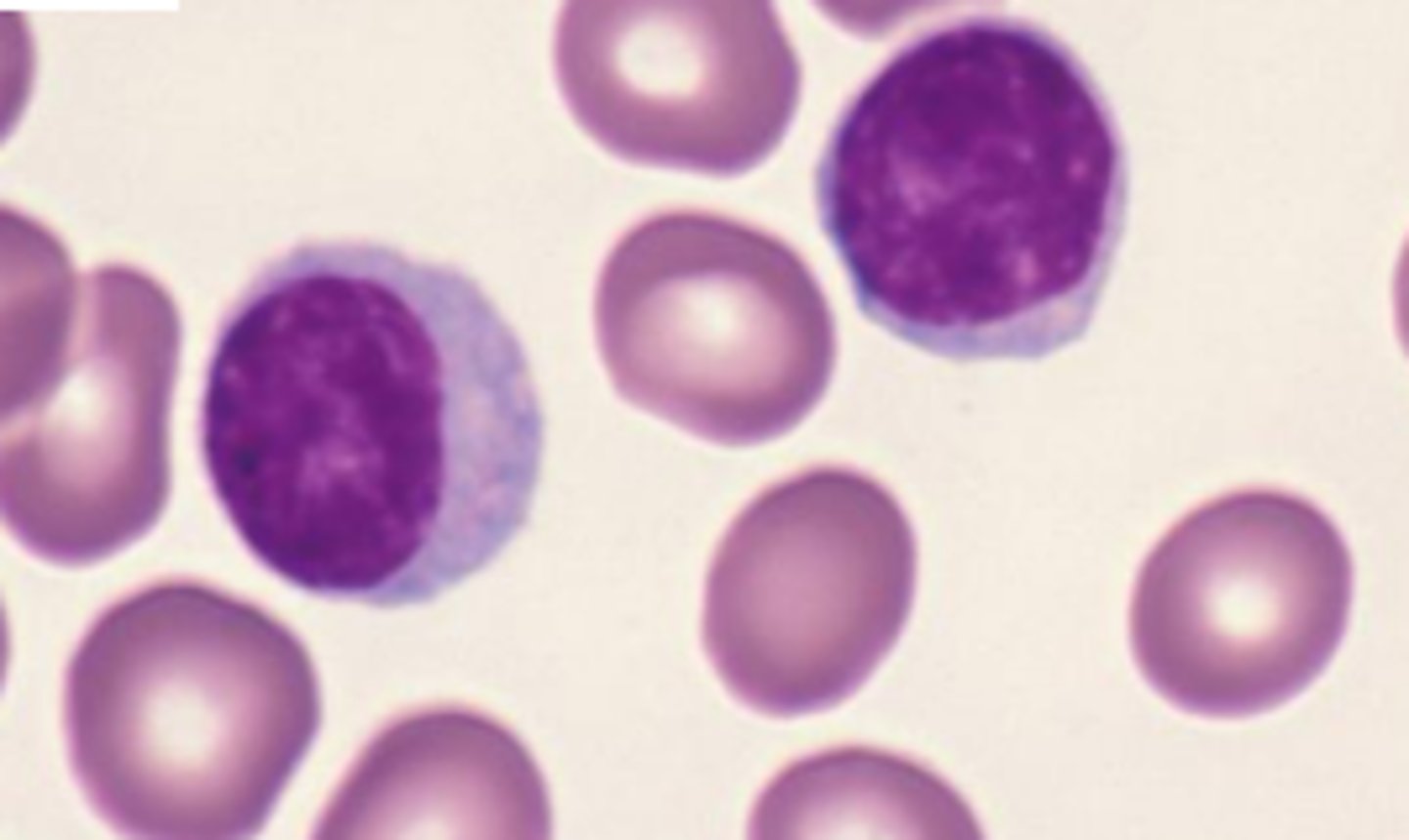 <p>what leukocyte is this?</p>