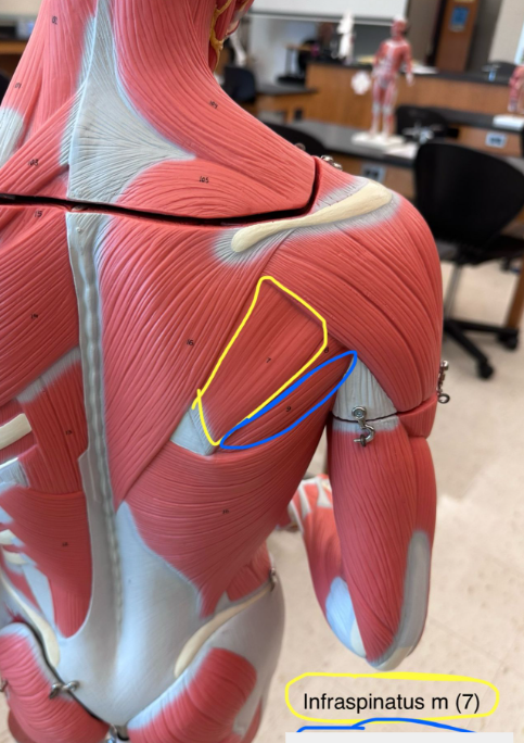<p>Infraspinatus muscle</p>
