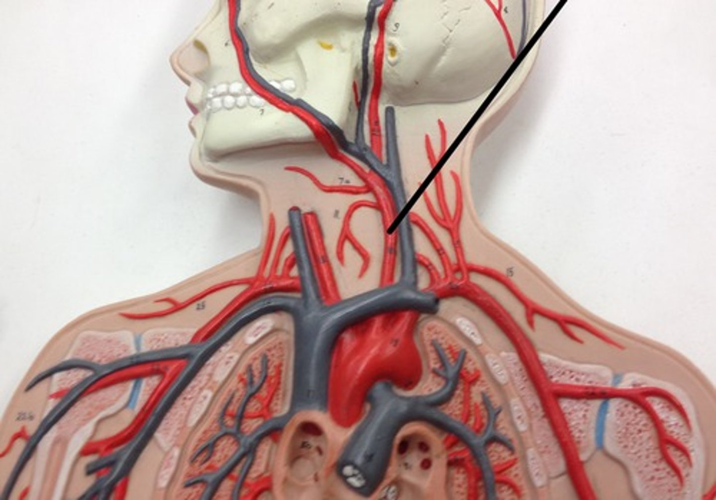 <p>What structure?</p>