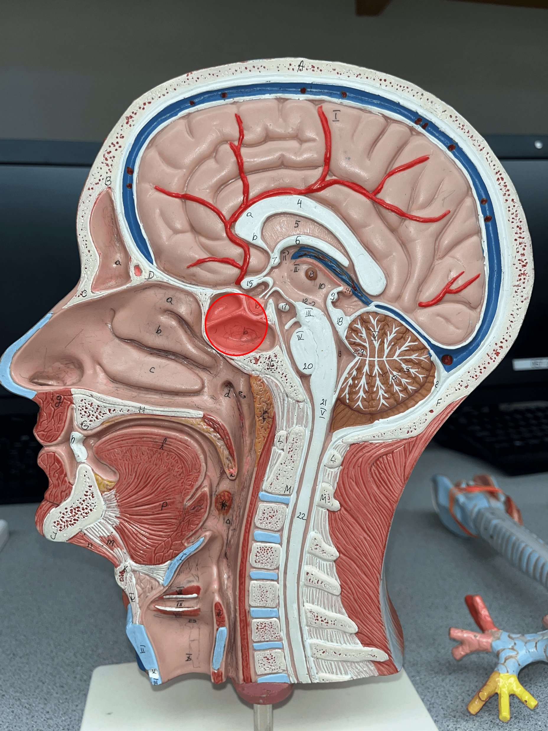 • A sinus within the sphenoid bone.

• Located superior to the internal nares.