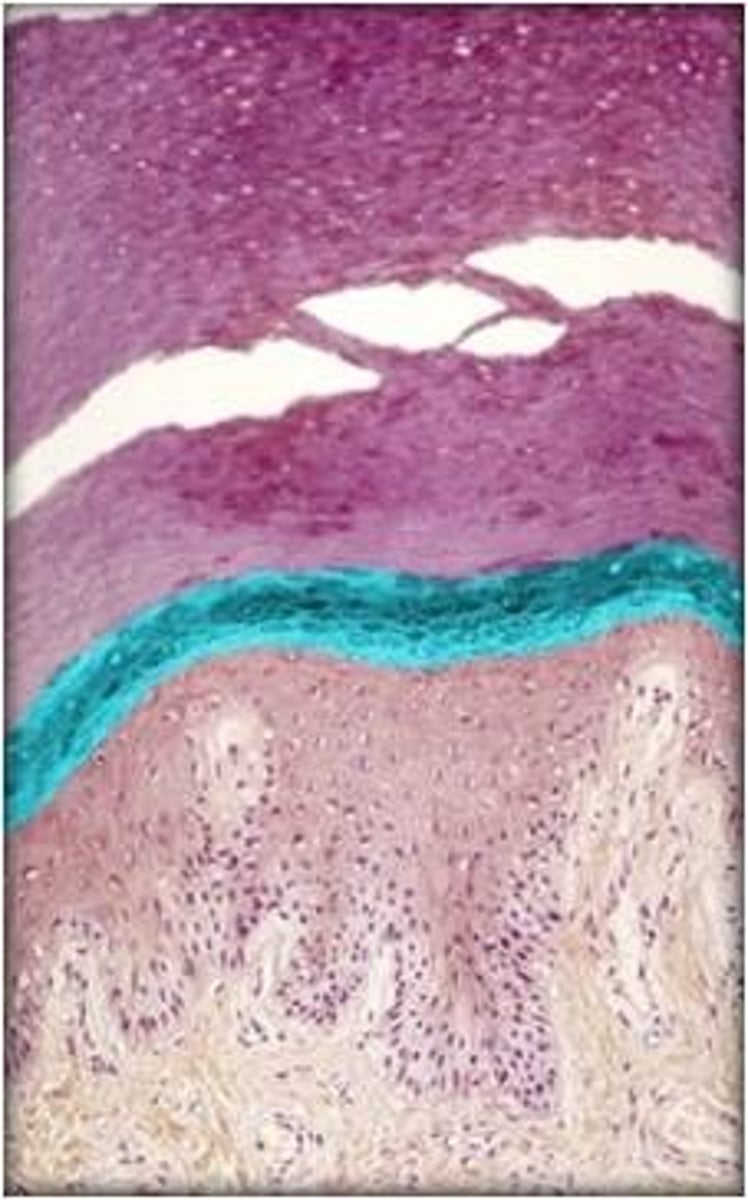<p>keratinocytes go through keratinization</p>