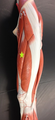 <p><strong>Rectus Femoris </strong><sub><sup>(bi-articular muscle)</sup></sub></p><ul><li><p><span style="color: #2ff916">Origin</span>: Anterior inferior iliac spine (AIIS)</p></li><li><p><span style="color: #0db1ff">Insertion</span><span style="color: #05171f">: Patella</span></p></li><li><p><span style="color: #ff0000">Action</span>: <strong>Flex</strong> Hip &amp; <strong>Extend</strong> Knee</p></li></ul><p></p>