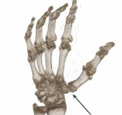<p>What joint is the <strong>Arrow </strong>pointing at called?</p>