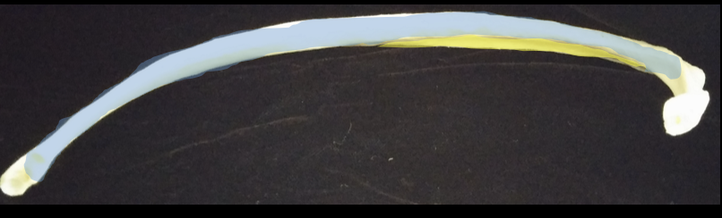 <p>yellow portion</p>