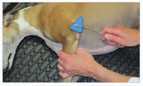 triceps reflex