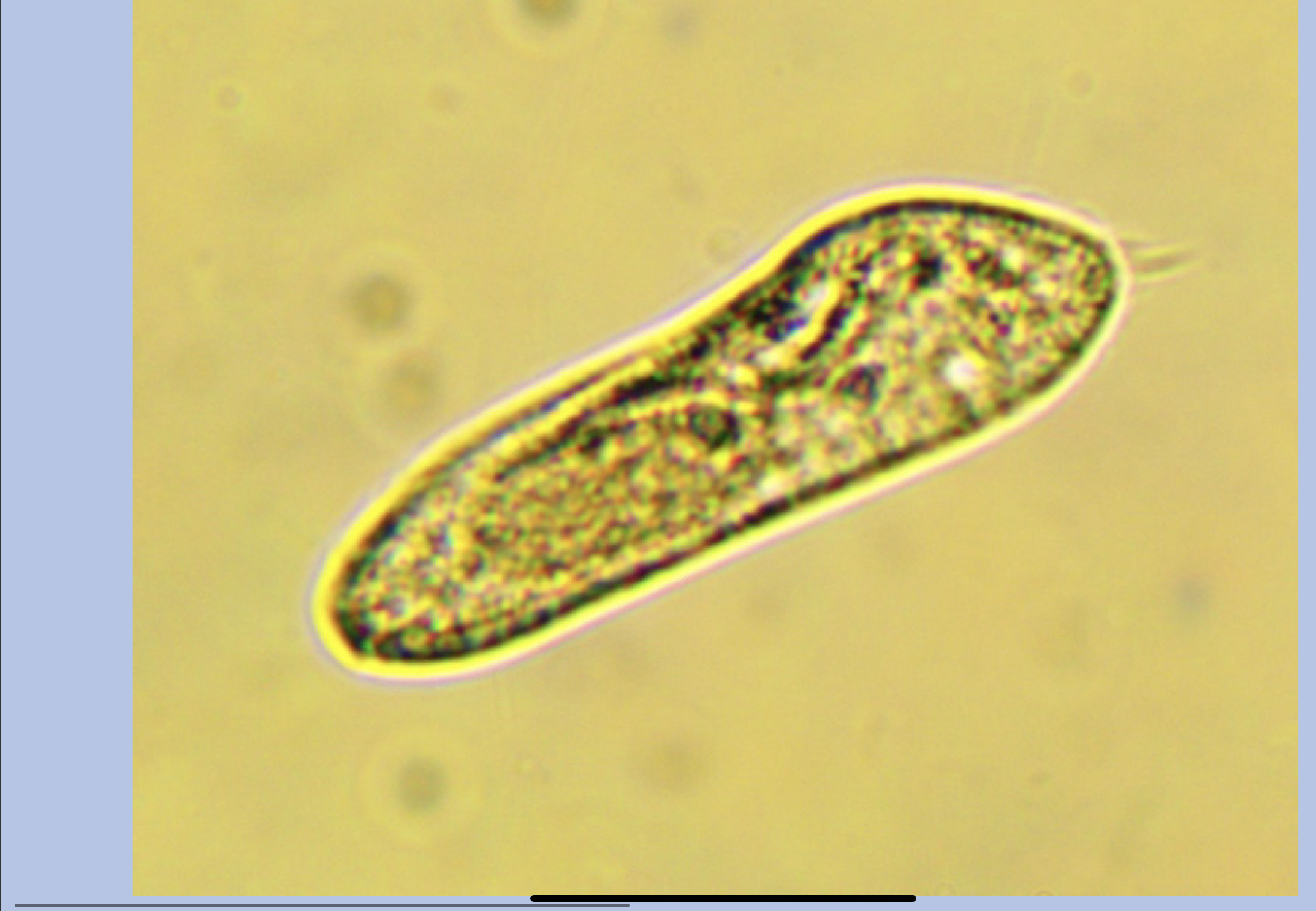 <p>what is this organism?</p>