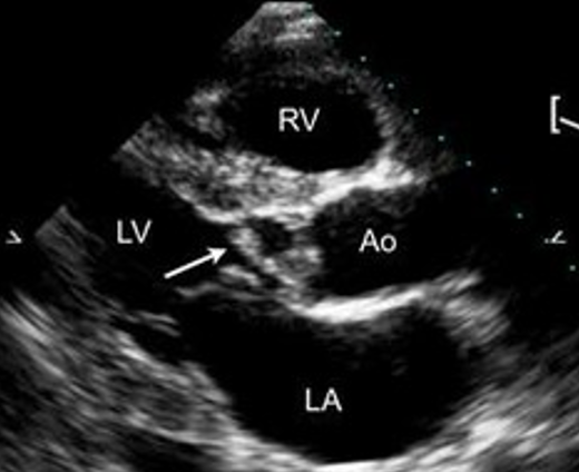 <p><strong>mobile </strong>vegetation</p>