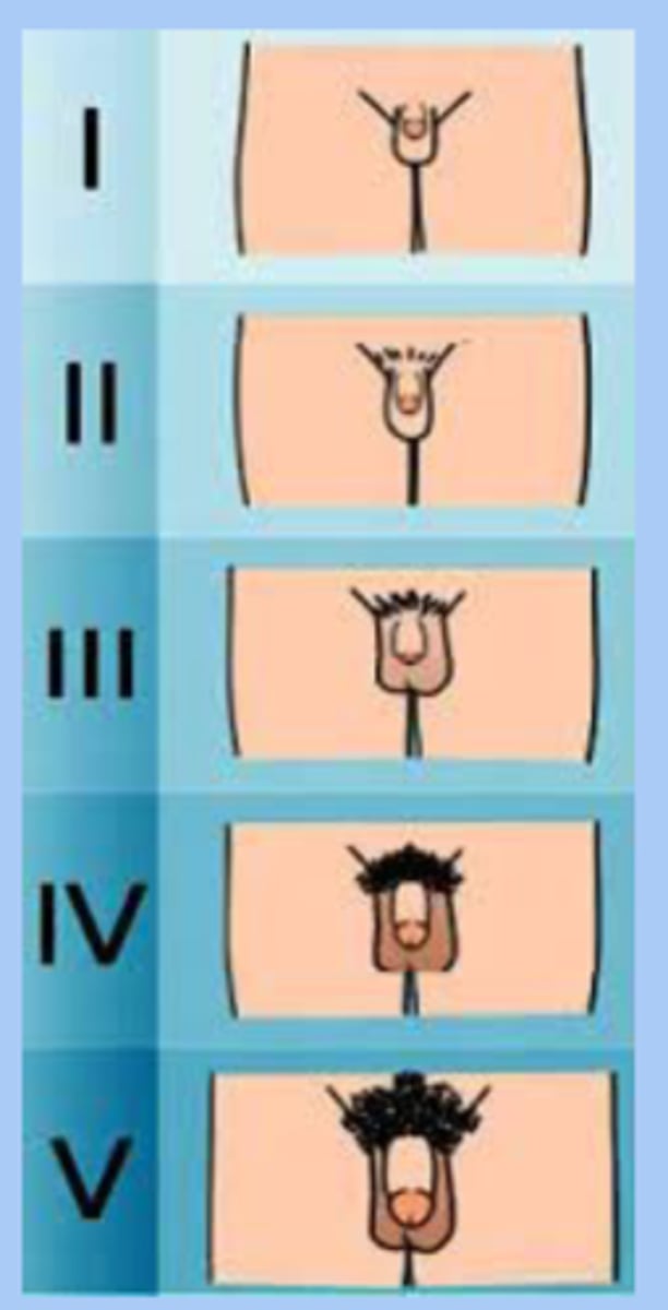 <p>-stage 1: testes and scrotum and penis same size</p><p>-stage 2: testes get larger, thickening and reddening of skin, light hair</p><p>-stage 3: growth of penis in length and width, more hair darker</p><p>-stage 4: further largening of penis and scrotum and dark hair</p><p>-stage 5: genitalia in adult size, adult hair</p>