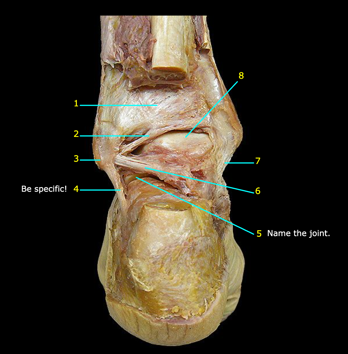 <p>What structure is labeled 5?</p>