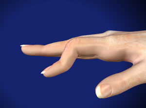 <p>Boutonniere Finger</p>