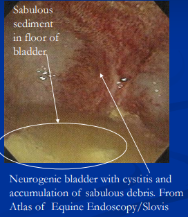<p><span style="background-color: transparent;"><strong>Neurogenic Bladder</strong></span></p>