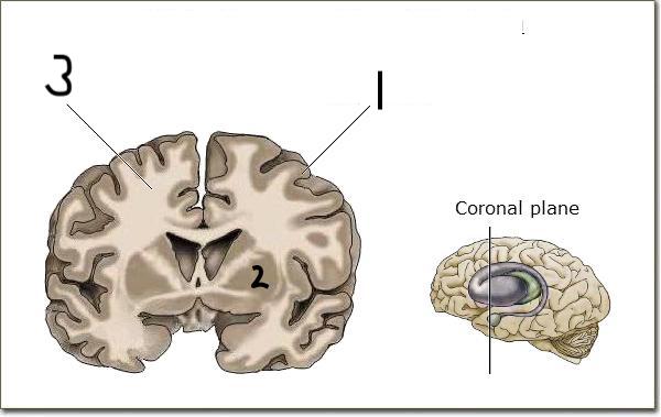 <p>outer gray matter in cerebrum</p>