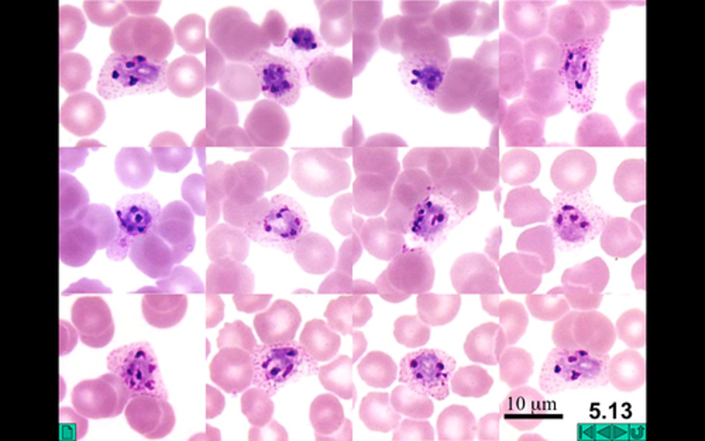 <p>*6-14 merozoites with large nuclei clustered in a mass of dark pigment</p>