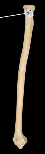 <p>Radius, lateral view, right side</p>
