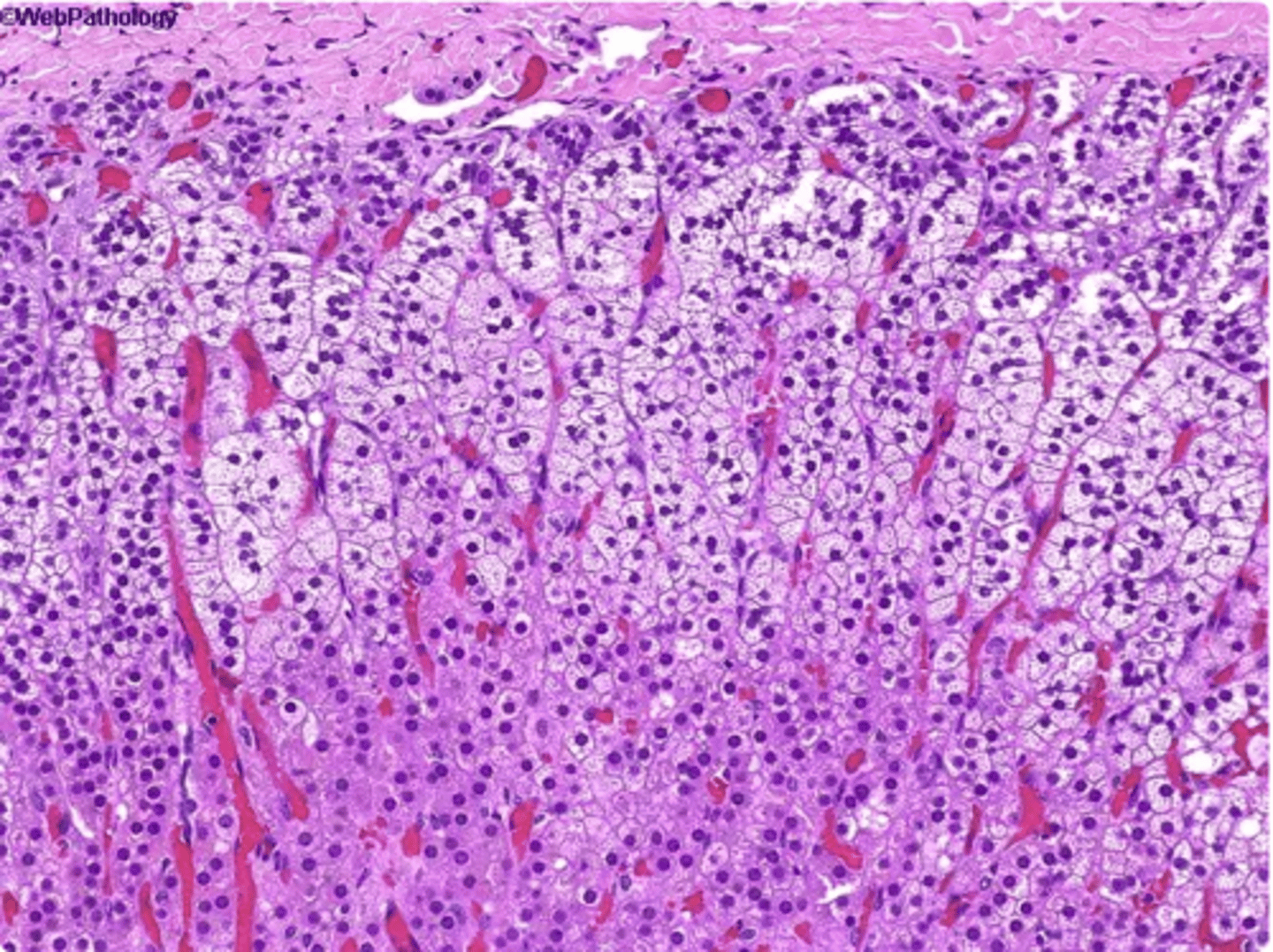 <p>capsule + All Three Zones (glandular tissue)</p>