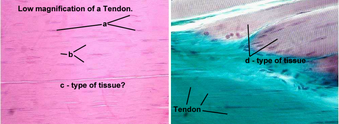 <p>Low Magnification of Tendon</p>